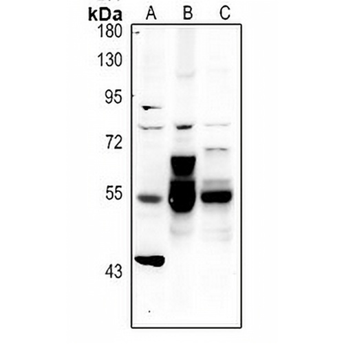 Alpha-internexin Rabbit Polyclonal Antibody