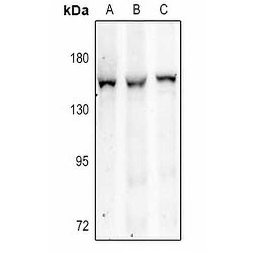 ITIH4 Rabbit Polyclonal Antibody