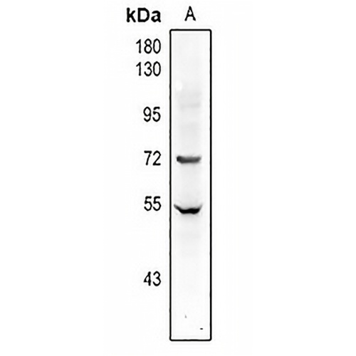 Factor XI HC Rabbit Polyclonal Antibody
