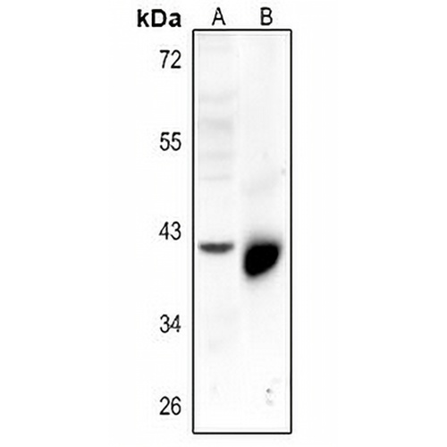 5-HT4 Rabbit Polyclonal Antibody