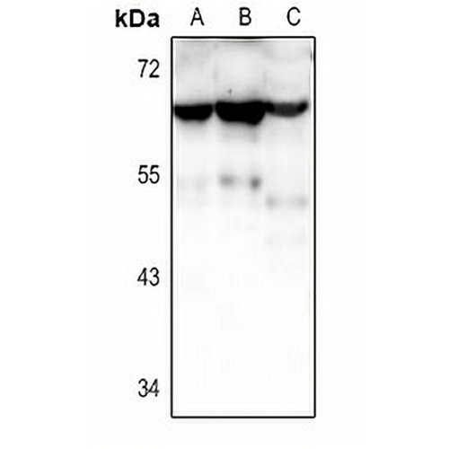 CRHR2 Rabbit Polyclonal Antibody