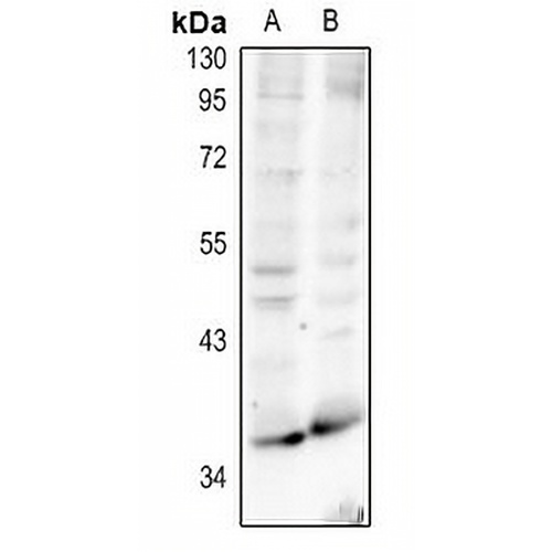 RRH Rabbit Polyclonal Antibody