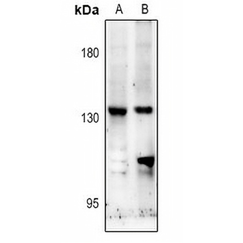 NMDAR2C Rabbit Polyclonal Antibody