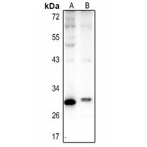Carbonic Anhydrase 1 Rabbit Polyclonal Antibody
