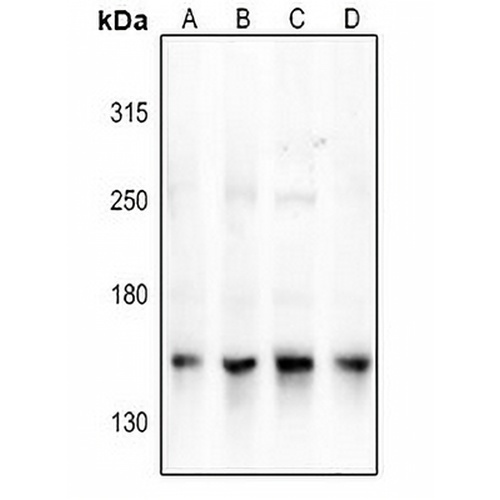 NCOA3 Rabbit Polyclonal Antibody
