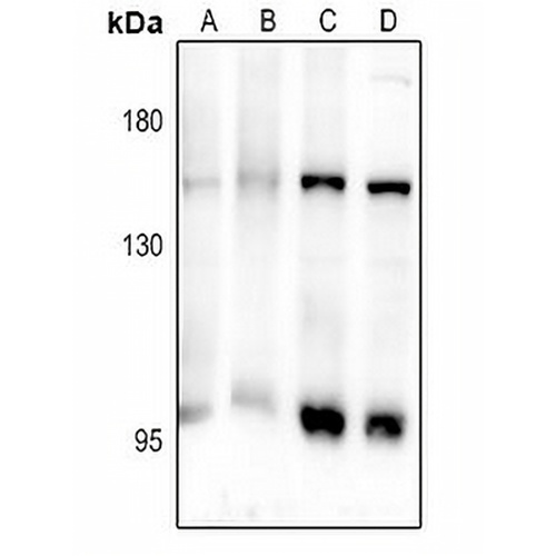CD103 Rabbit Polyclonal Antibody