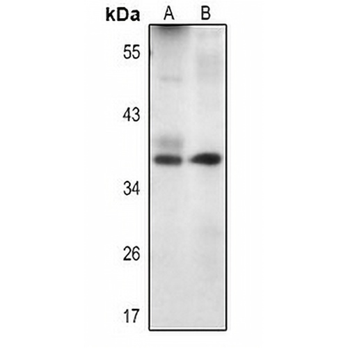 Livin Rabbit Polyclonal Antibody