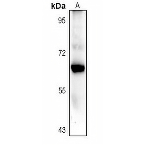 CARM1 Rabbit Polyclonal Antibody