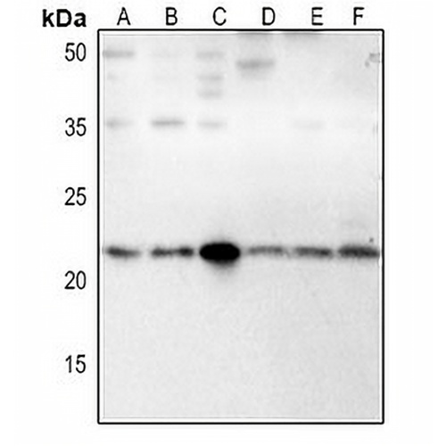IFN beta Rabbit Polyclonal Antibody