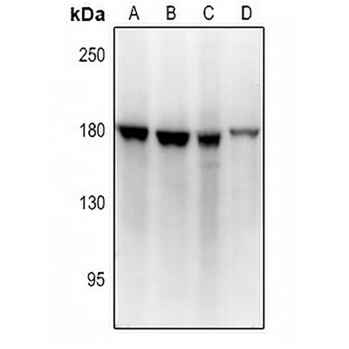 BMP1 Rabbit Polyclonal Antibody