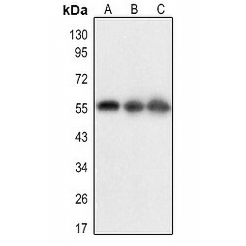 BACE1 (Acetyl-K316) Rabbit Polyclonal Antibody