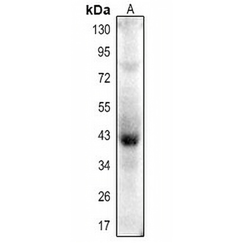 Actin-pan (Acetyl-K52/50/51) Rabbit Polyclonal Antibody