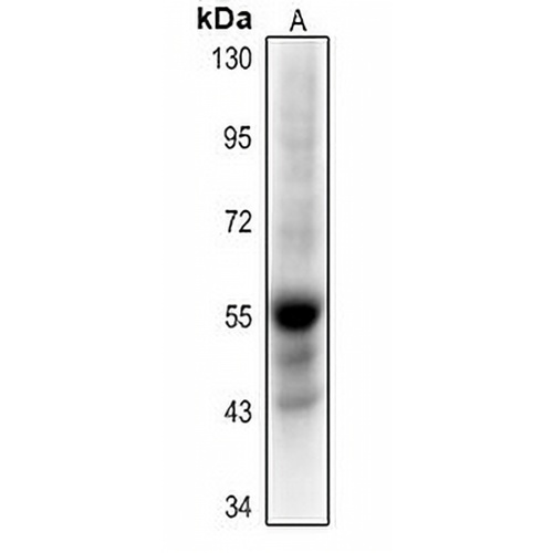 Histone Deacetylase 1 (Acetyl-K220) Rabbit Polyclonal Antibody
