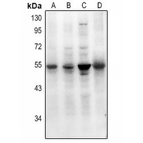 SMAD7 (Acetyl-K70) Rabbit Polyclonal Antibody