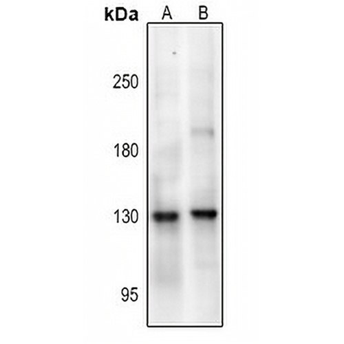 NMDAR1 (Phospho-S890) Rabbit Polyclonal Antibody