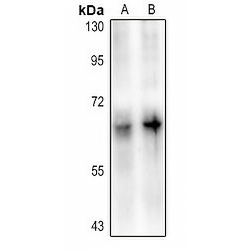 DAB1 (Phospho-Y220) Rabbit Polyclonal Antibody