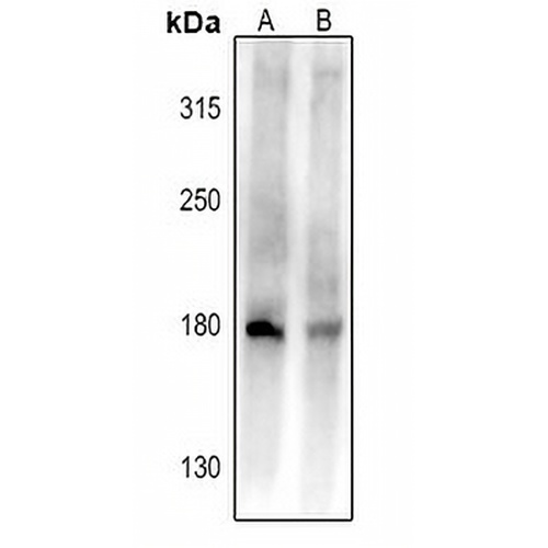 CD45 Rabbit Polyclonal Antibody