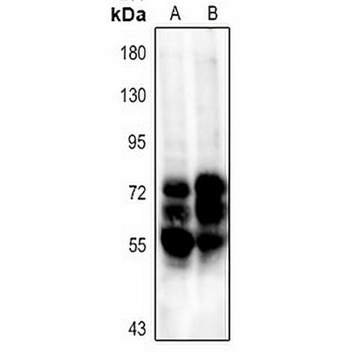TAU Rabbit Polyclonal Antibody