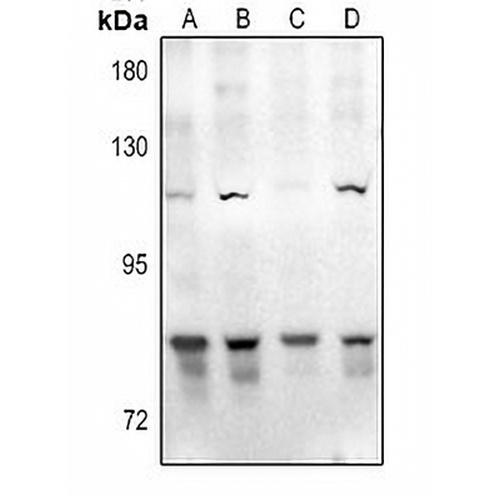 GAB2 Rabbit Polyclonal Antibody