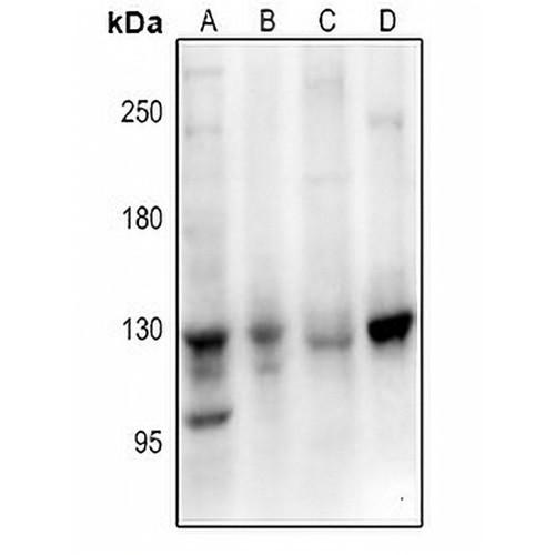 EPHB1/2/3 Rabbit Polyclonal Antibody