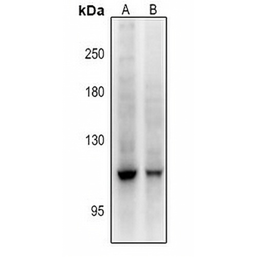 DGK zeta Rabbit Polyclonal Antibody