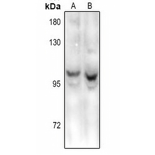 HPC2 Rabbit Polyclonal Antibody