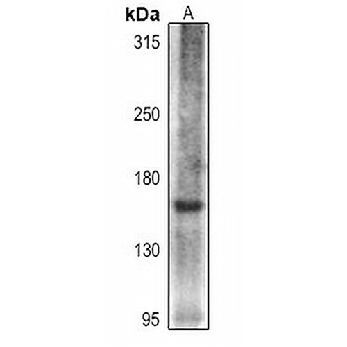 Collagen 16 alpha 1 Rabbit Polyclonal Antibody