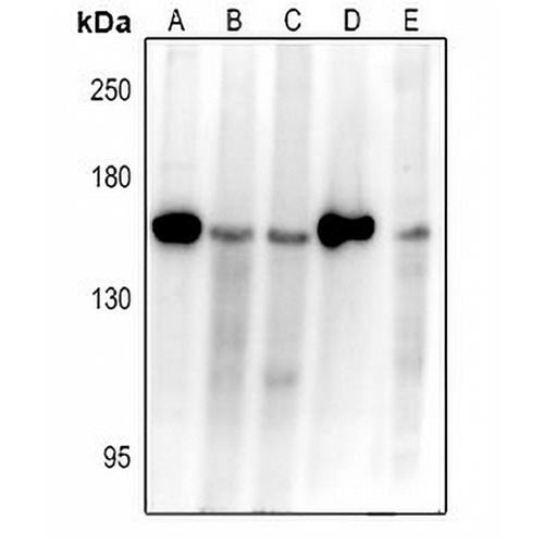APAF-1 Rabbit Polyclonal Antibody