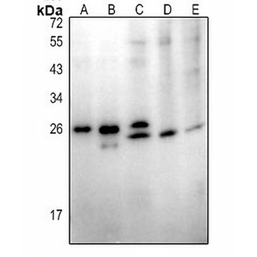 ABHD14B Rabbit Polyclonal Antibody