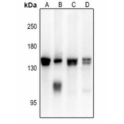 ADAMTS16 Rabbit Polyclonal Antibody