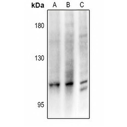 CCP3 Rabbit Polyclonal Antibody