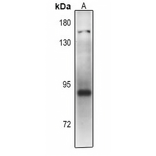 PLA2G4D Rabbit Polyclonal Antibody