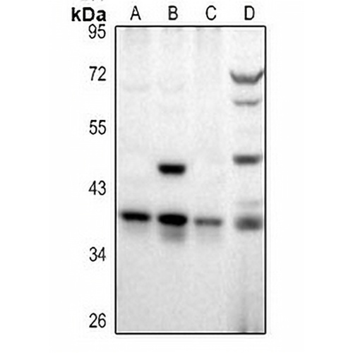 RALY Rabbit Polyclonal Antibody