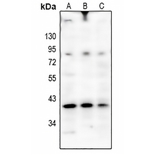 OSR2 Rabbit Polyclonal Antibody