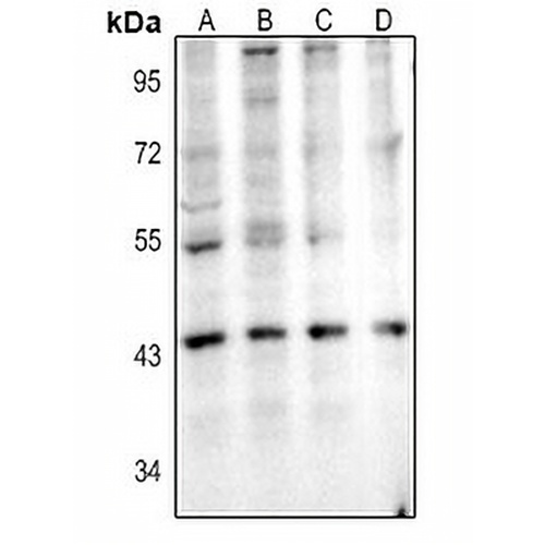 IL-11RA Rabbit Polyclonal Antibody