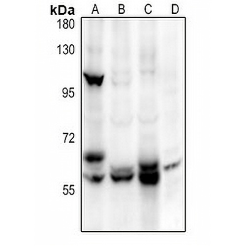 ALPL Rabbit Polyclonal Antibody