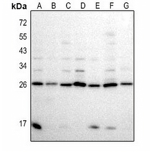 BCL7A Rabbit Polyclonal Antibody