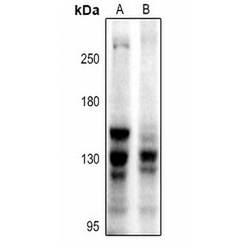 BUB1 Rabbit Polyclonal Antibody