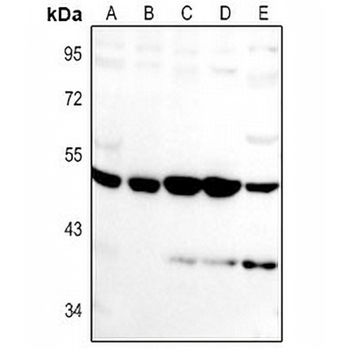 VASH1 Rabbit Polyclonal Antibody