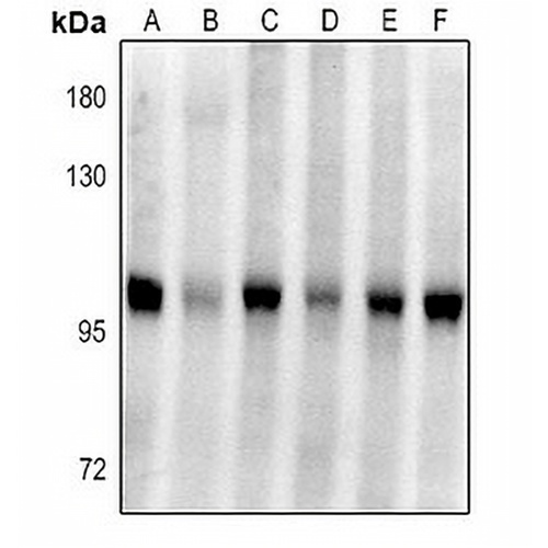 Plasminogen Rabbit Polyclonal Antibody