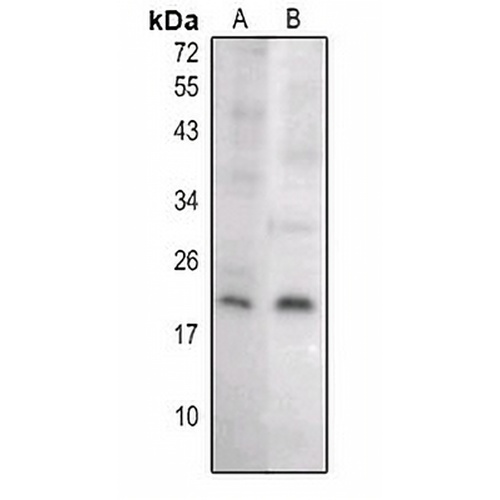 Caspase 8 p18 Rabbit Polyclonal Antibody