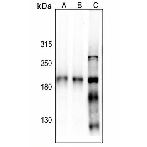NMDAR2B Rabbit Polyclonal Antibody