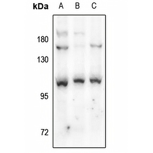 MMP9 Rabbit Polyclonal Antibody