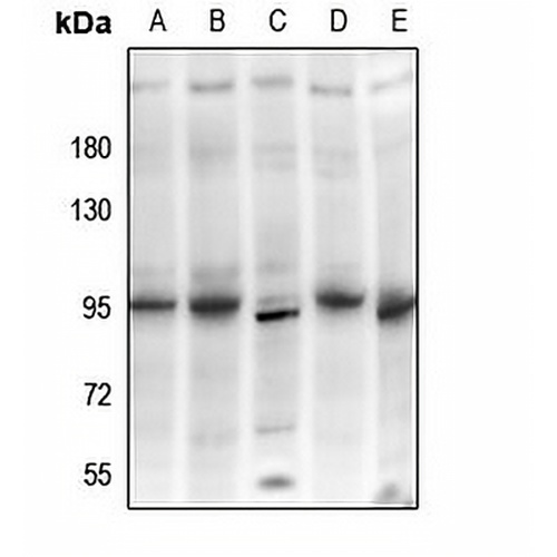 PI3K p85 beta Rabbit Polyclonal Antibody