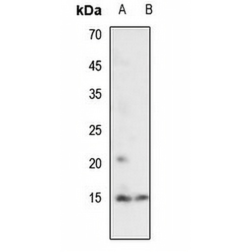 Histone H2A (Acetyl-K7) Rabbit Polyclonal Antibody