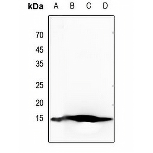 Histone H2B (Acetyl-K20) Rabbit Polyclonal Antibody