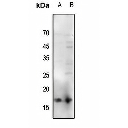 Histone H3 (Acetyl-K56) Rabbit Polyclonal Antibody
