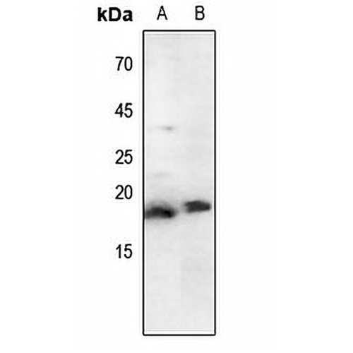 Histone H3 (Acetyl-K79) Rabbit Polyclonal Antibody