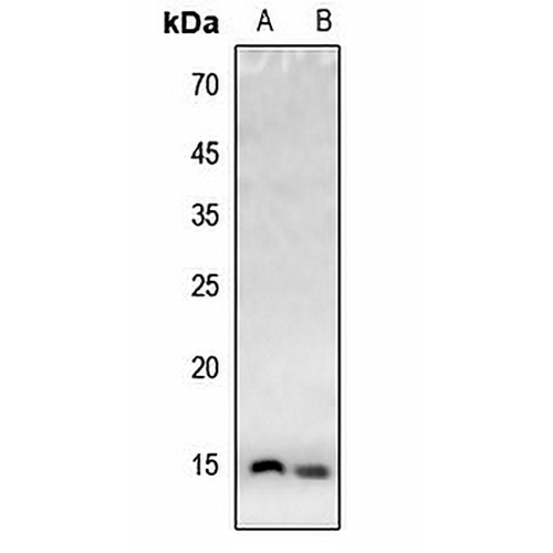 Histone H4 (Acetyl-K20) Rabbit Polyclonal Antibody