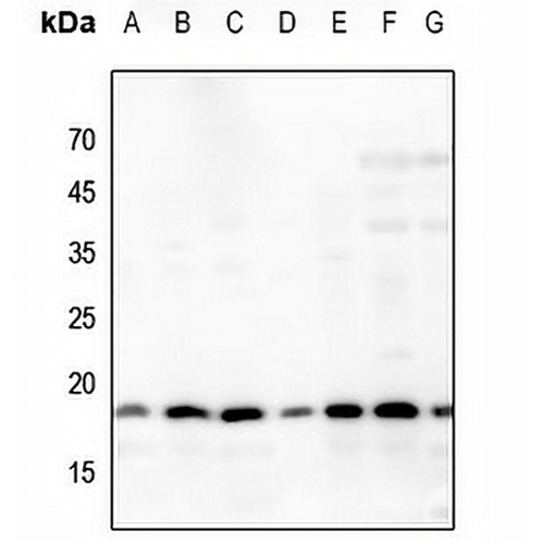 Histone H3 (Acetyl-K64) Rabbit Polyclonal Antibody